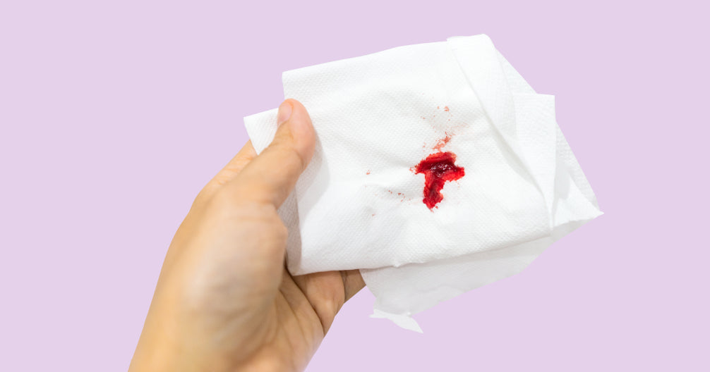 Bleeding After Sex: When It's Normal vs. When to See a Doctor (Complete Guide)